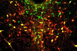 MIT-Lonely-Neurons_0 (1)