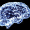 neuropace brain image
